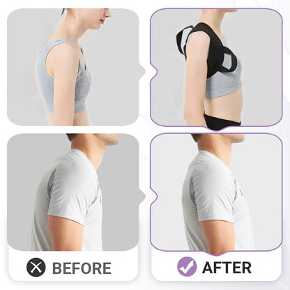 ⏰SALE 50% OFF🔥Back Posture Correction Belt for Men & Women