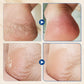 🧴Hydrating and Anti-Cracking Foot Cream